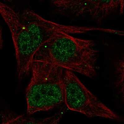 Immunocytochemistry/ Immunofluorescence: AKNA Antibody [NBP2-56850]