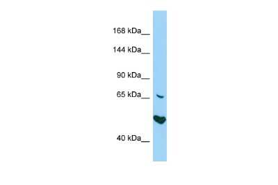 Western Blot: AKNA Antibody [NBP2-84415]