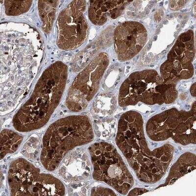 Immunohistochemistry: AKNAD1 Antibody [NBP1-90704]