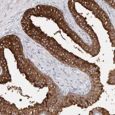 Immunohistochemistry-Paraffin: AKNAD1 Antibody [NBP1-90705]