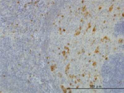 Immunohistochemistry-Paraffin: AKR1A1 Antibody (1A11-2A4) [H00010327-M01]