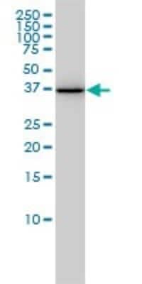 Western Blot: AKR1A1 Antibody (1A11-2A4) [H00010327-M01]