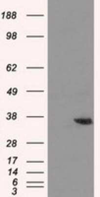 Western Blot: AKR1A1 Antibody (OTI6E3) [NBP2-02164]