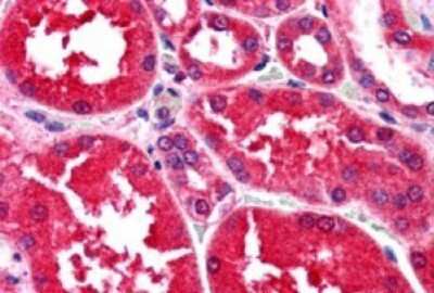 Immunohistochemistry-Paraffin: AKR1A1 Antibody [NB100-1074]