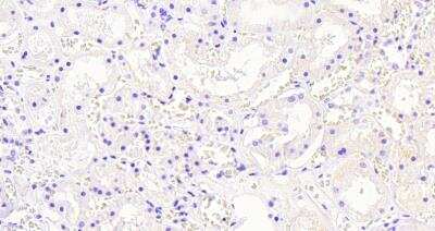 Immunohistochemistry-Paraffin: AKR1A1 Antibody [NB100-1074]