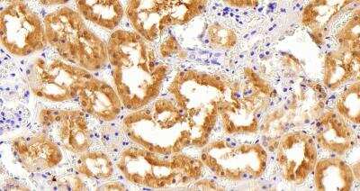 Immunohistochemistry-Paraffin: AKR1A1 Antibody [NB100-1074]