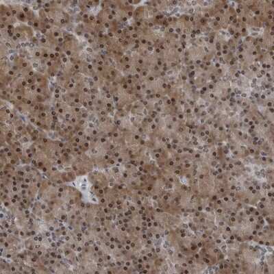 Immunohistochemistry-Paraffin: AKR1A1 Antibody [NBP1-89120]