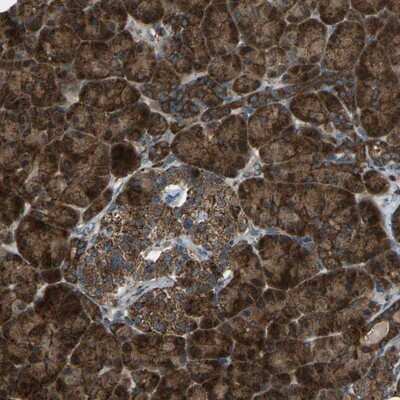 Immunohistochemistry-Paraffin: AKR1A1 Antibody [NBP1-89121]