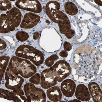Immunohistochemistry-Paraffin: AKR1A1 Antibody [NBP1-89122]