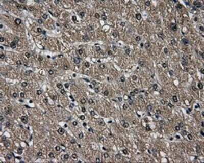 Immunohistochemistry: AKR1A1 Antibody (OTI6E3) - Azide and BSA Free [NBP2-71591]