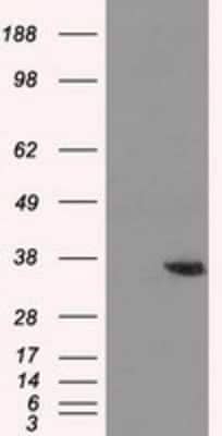 Western Blot: AKR1A1 Antibody (OTI6E3)Azide and BSA Free [NBP2-71591]