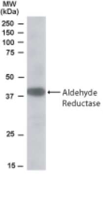 Western Blot: AKR1A1 Antibody [NB100-1074]