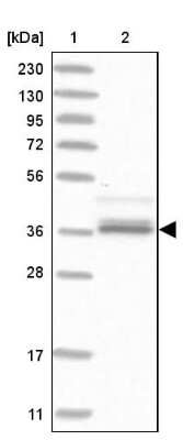 Western Blot: AKR1A1 Antibody [NBP1-89120]