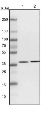 Western Blot: AKR1A1 Antibody [NBP1-89120]