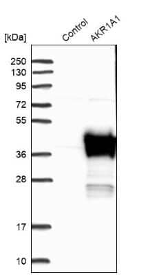 Western Blot: AKR1A1 Antibody [NBP1-89121]