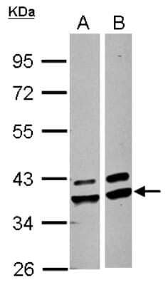 Western Blot: AKR1A1 Antibody [NBP2-15321]