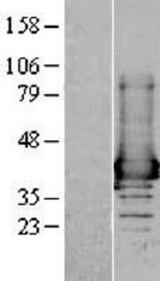 Western Blot: AKR1A1 Overexpression Lysate [NBL1-07432]