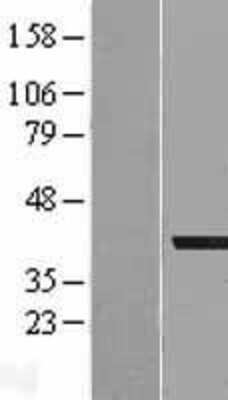 Western Blot: AKR1A1 Overexpression Lysate [NBL1-07433]