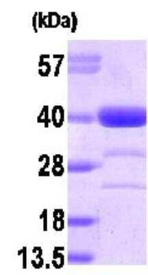 Western Blot: Recombinant Human AKR1A1 Protein [NBP1-30170]