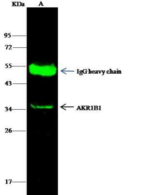 Immunoprecipitation: AKR1B1 Antibody (109) [NBP2-89882]