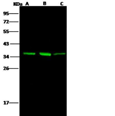 Western Blot: AKR1B1 Antibody (109) [NBP2-89882]