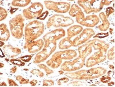 Immunohistochemistry-Paraffin: AKR1B1 Antibody (AKR1B1/7009R) [NBP3-13896]