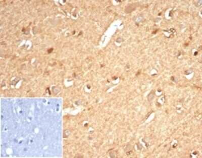 Immunohistochemistry-Paraffin: AKR1B1 Antibody (AKR1B1/7010R) [NBP3-13897]