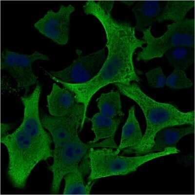 Immunocytochemistry/ Immunofluorescence: AKR1B1 Antibody (CPTC-AKR1B1-2) - Azide and BSA Free [NBP2-79931]