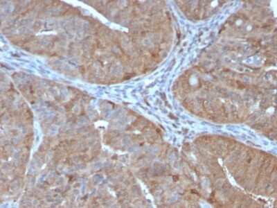 Immunohistochemistry-Paraffin: AKR1B1 Antibody (CPTC-AKR1B1-2) - Azide and BSA Free [NBP2-79931]