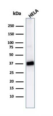 Western Blot: AKR1B1 Antibody (CPTC-AKR1B1-2)Azide and BSA Free [NBP2-79931]