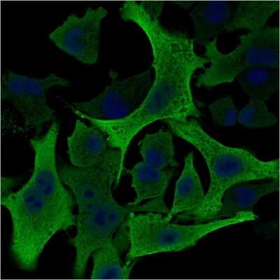 Immunocytochemistry/ Immunofluorescence: AKR1B1 Antibody (CPTC-AKR1B1-2) [NBP2-79797]