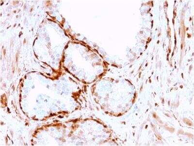 Immunohistochemistry-Paraffin: AKR1B1 Antibody (CPTC-AKR1B1-3) - Azide and BSA Free [NBP2-79930]