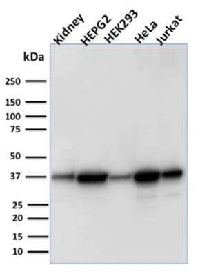 Western Blot: AKR1B1 Antibody (CPTC-AKR1B1-3)Azide and BSA Free [NBP2-79930]