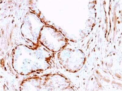 Immunohistochemistry-Paraffin: AKR1B1 Antibody (CPTC-AKR1B1-3) [NBP2-79796]