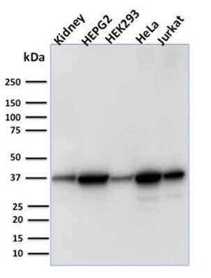 Western Blot: AKR1B1 Antibody (CPTC-AKR1B1-3) [NBP2-79796]