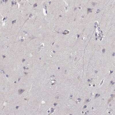 Immunohistochemistry-Paraffin: AKR1B1 Antibody [NBP1-89146]