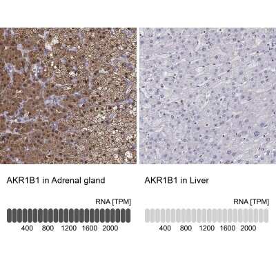 Immunohistochemistry-Paraffin: AKR1B1 Antibody [NBP1-89146]