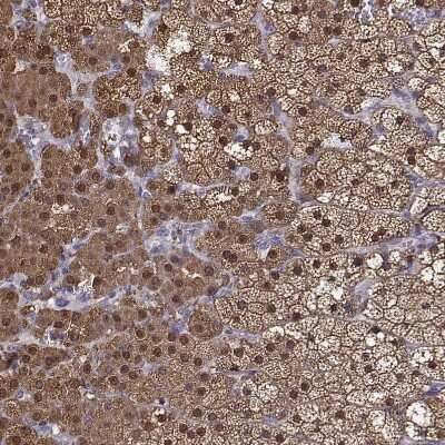Immunohistochemistry-Paraffin: AKR1B1 Antibody [NBP1-89146]