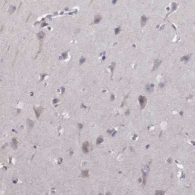 Immunohistochemistry-Paraffin: AKR1B1 Antibody [NBP1-89146]