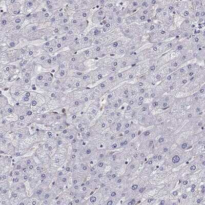 Immunohistochemistry-Paraffin: AKR1B1 Antibody [NBP1-89146]