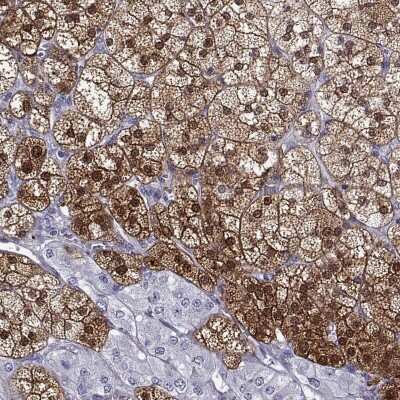 Immunohistochemistry-Paraffin: AKR1B1 Antibody [NBP2-56910]