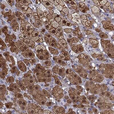 Immunohistochemistry-Paraffin: AKR1B1 Antibody [NBP2-56910]