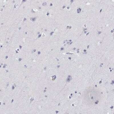 Immunohistochemistry-Paraffin: AKR1B1 Antibody [NBP2-56910]