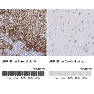 Immunohistochemistry-Paraffin: AKR1B1 Antibody [NBP2-56910]