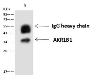 Immunoprecipitation: AKR1B1 Antibody [NBP2-97585]
