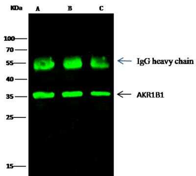 Immunoprecipitation: AKR1B1 Antibody [NBP2-99771]