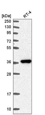 Western Blot: AKR1B1 Antibody [NBP2-56910]