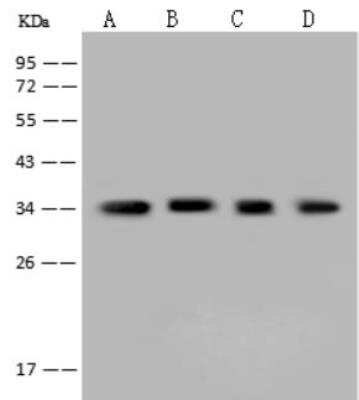 Western Blot: AKR1B1 Antibody [NBP2-97585]