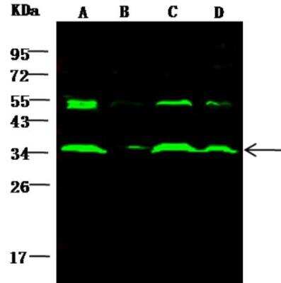 Western Blot: AKR1B1 Antibody [NBP2-99771]