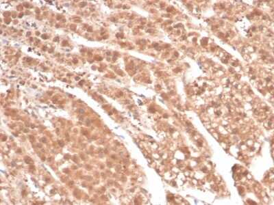 Immunohistochemistry-Paraffin: AKR1B1 Antibody (rAKR1B1/7295) [NBP3-13895]